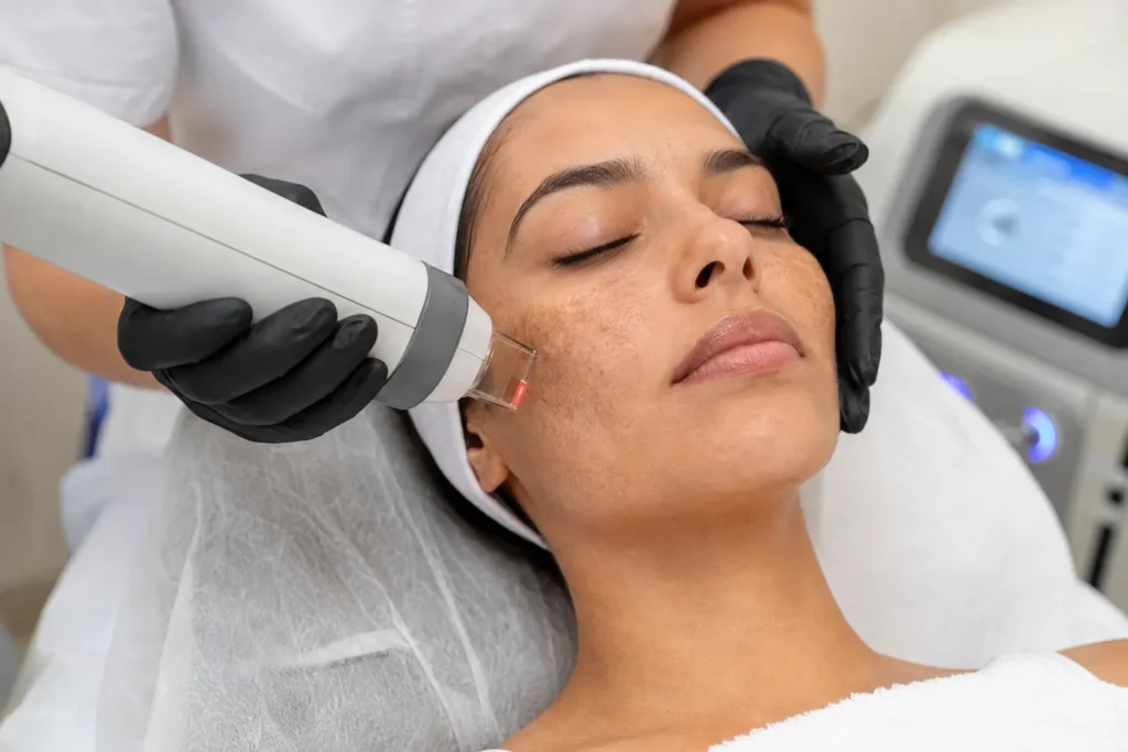 Pigmentation Treatment in Andheri West: Causes, Treatment Options & Prevention Tips